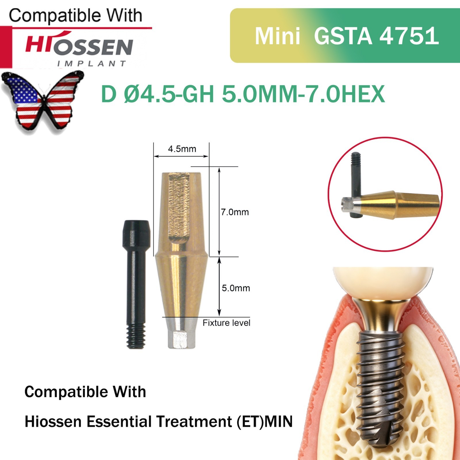 US Straight Abutment Fit Osstem Hiossen ET Mini Φ4.5 Cement Retained GH 1-5.0mm