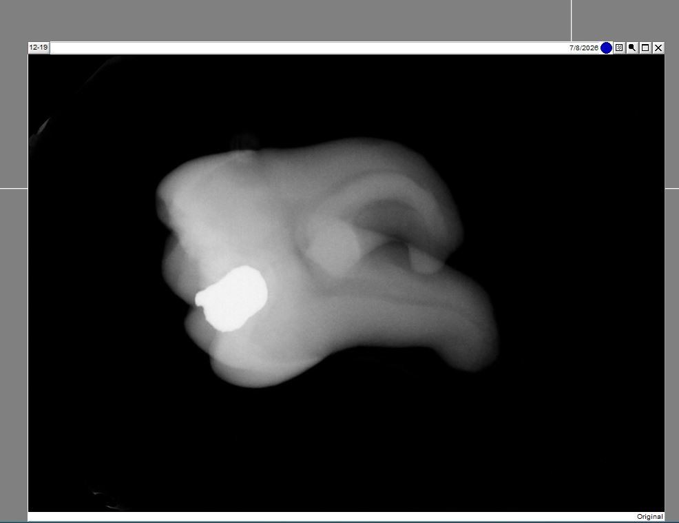 Dexis/Kavo IXS Size 2 Sensor _SEE PICTURES AND IMAGES_