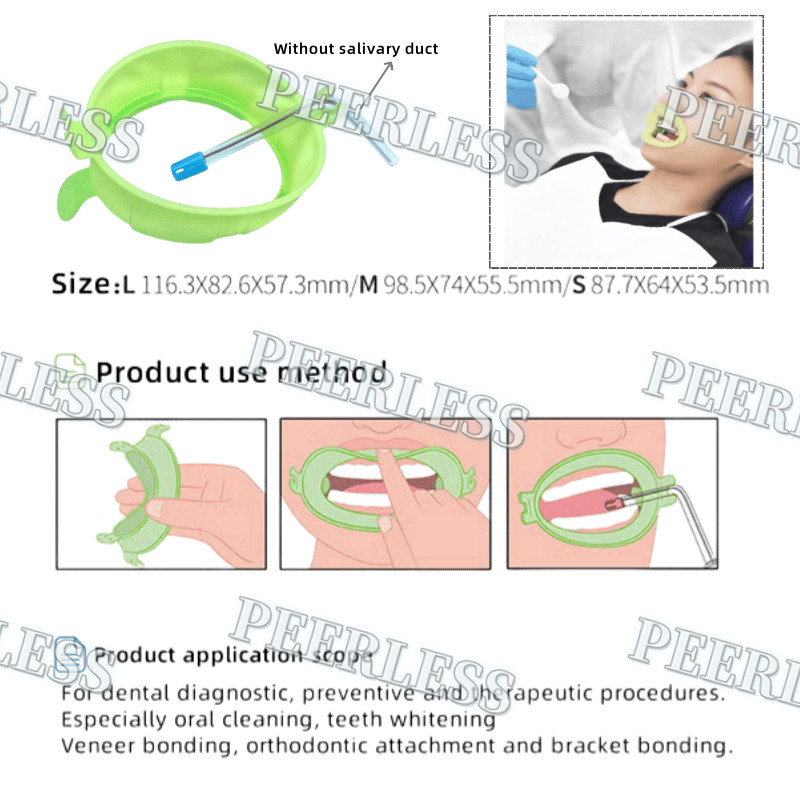 Smile Face Mouth Opener Orthodontic Buccal Mouth Reaming Internal Support S/M/L