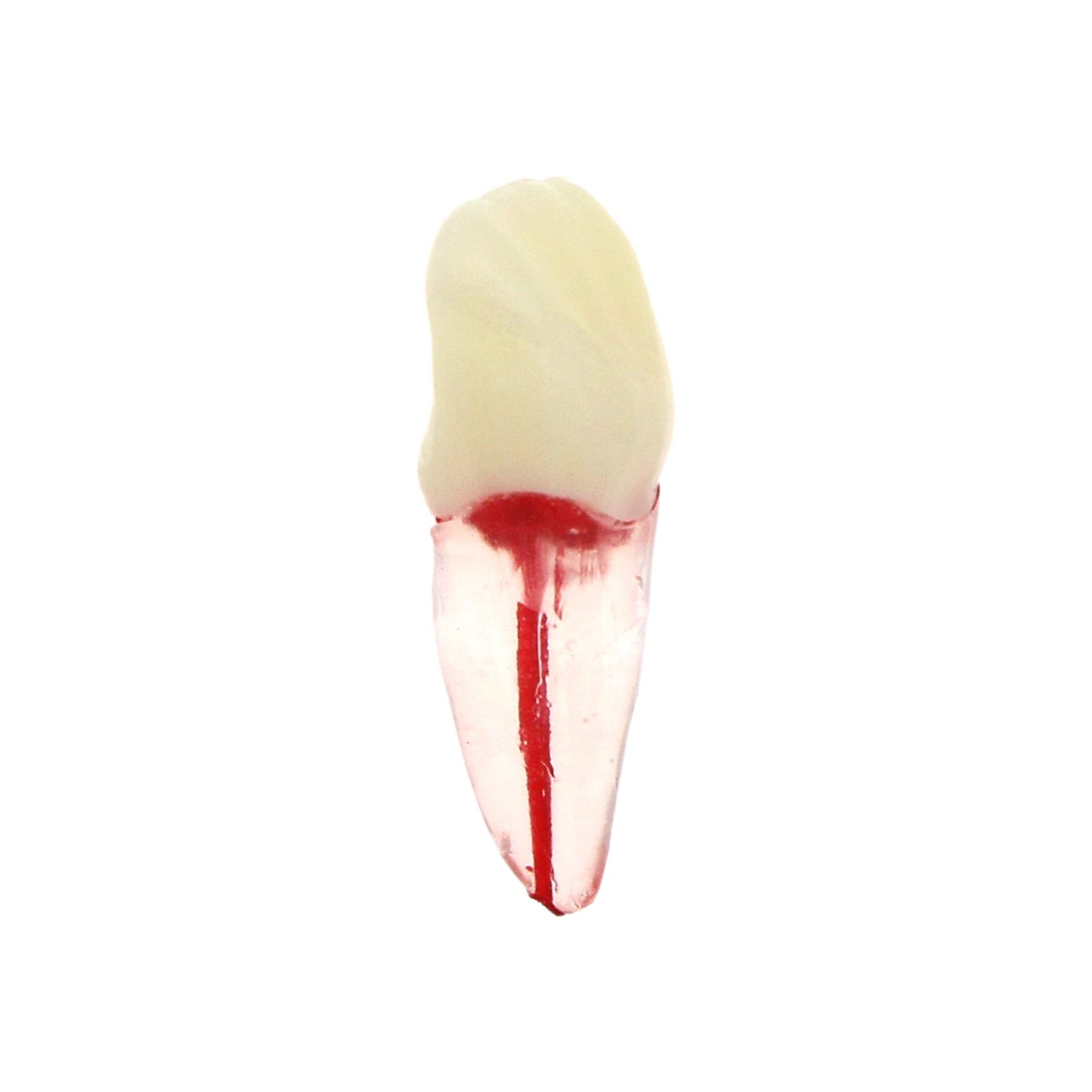 5Pcs Dental Root Canal Pulp Cavity Teeth Model Endodontic Practice RCT…