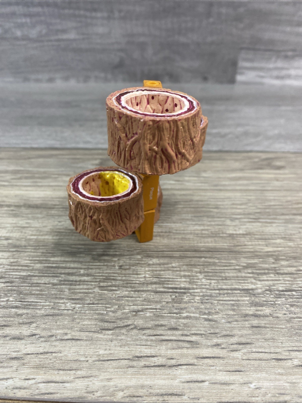 GPI 4-Piece Artery 1 part – Model #2650