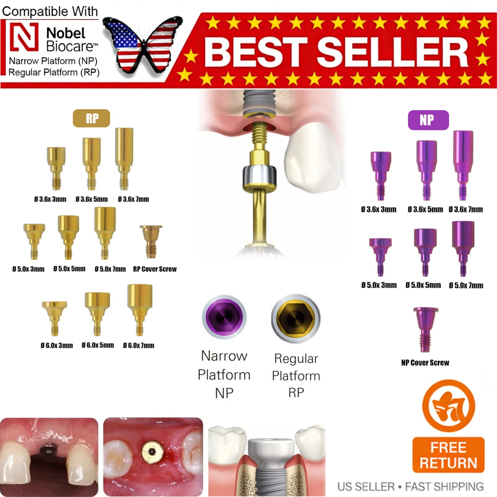 Multiple Implant Healing Abutment & Closure Cover Screw Hiossen Nobel Straumann