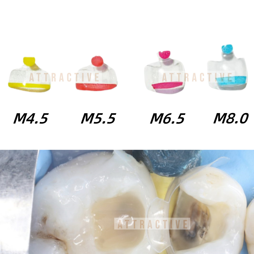 20Pcs Dental Clear Matrix Posterior Molar Matrices Similar Bioclear Matrice