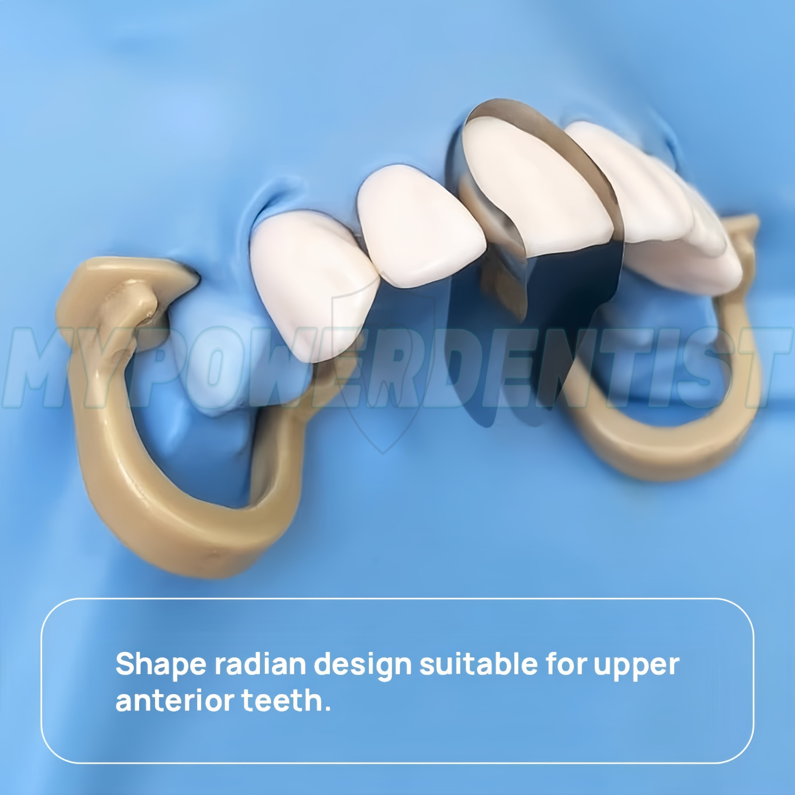 Dental Contoured Anterior Metal Matrix Bands Restoration Sectional M/S Matrices