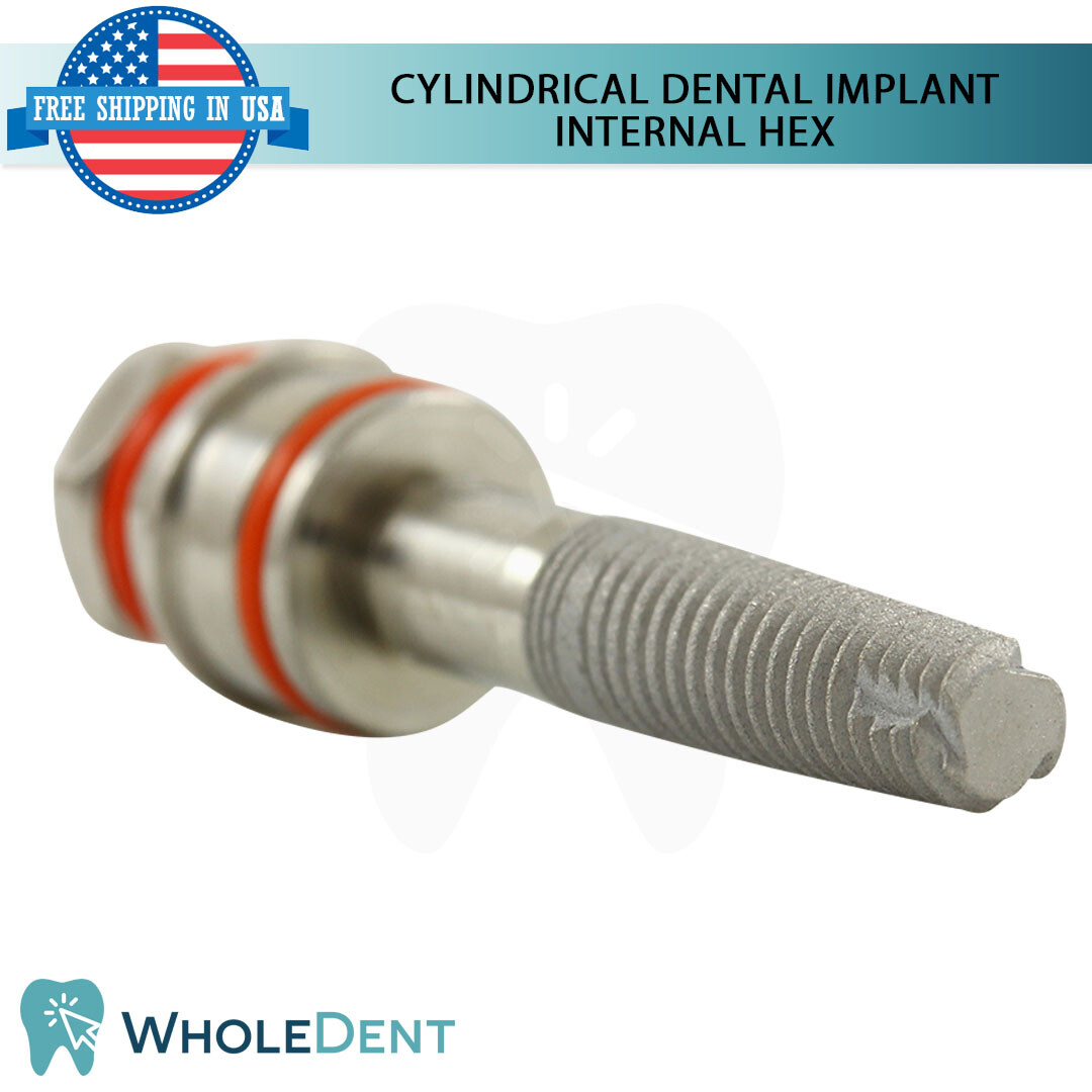 X1 Dental Cylindrical Int Hex Sterile SLA + Straight Abutment + Cement Set