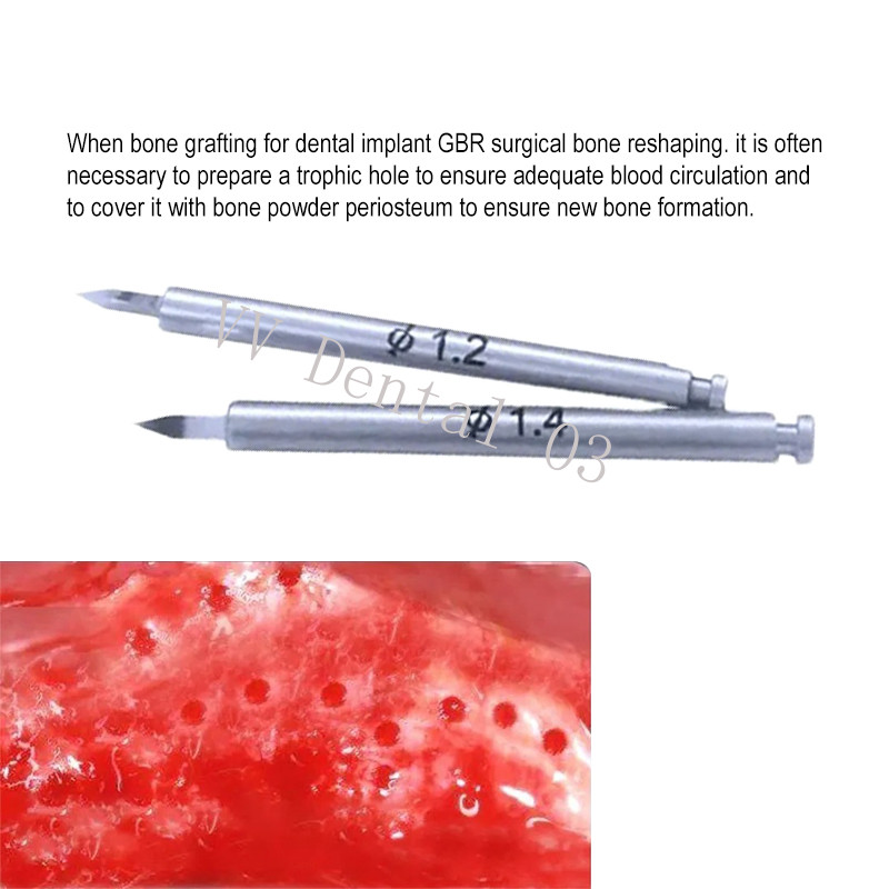 Dental Nutrient Drills GBR Drilling Promote Bone Growing Nourish Implant Holes