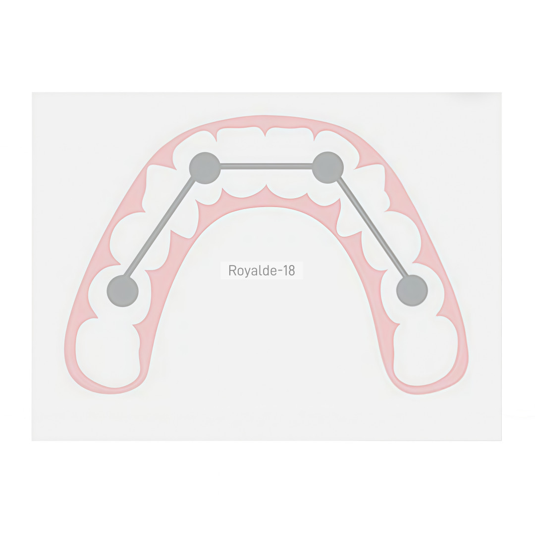 Dental Implan Connector Stainless Tianium Strengthener Wire Overdenture MU Wire
