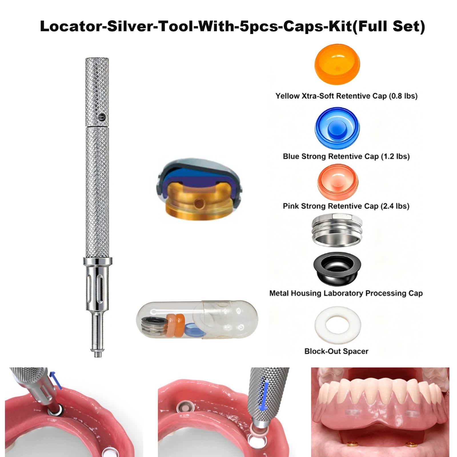 US Universal ZEST Locator PEEK Retention Cap Insertion Lab Core Extraction Tool