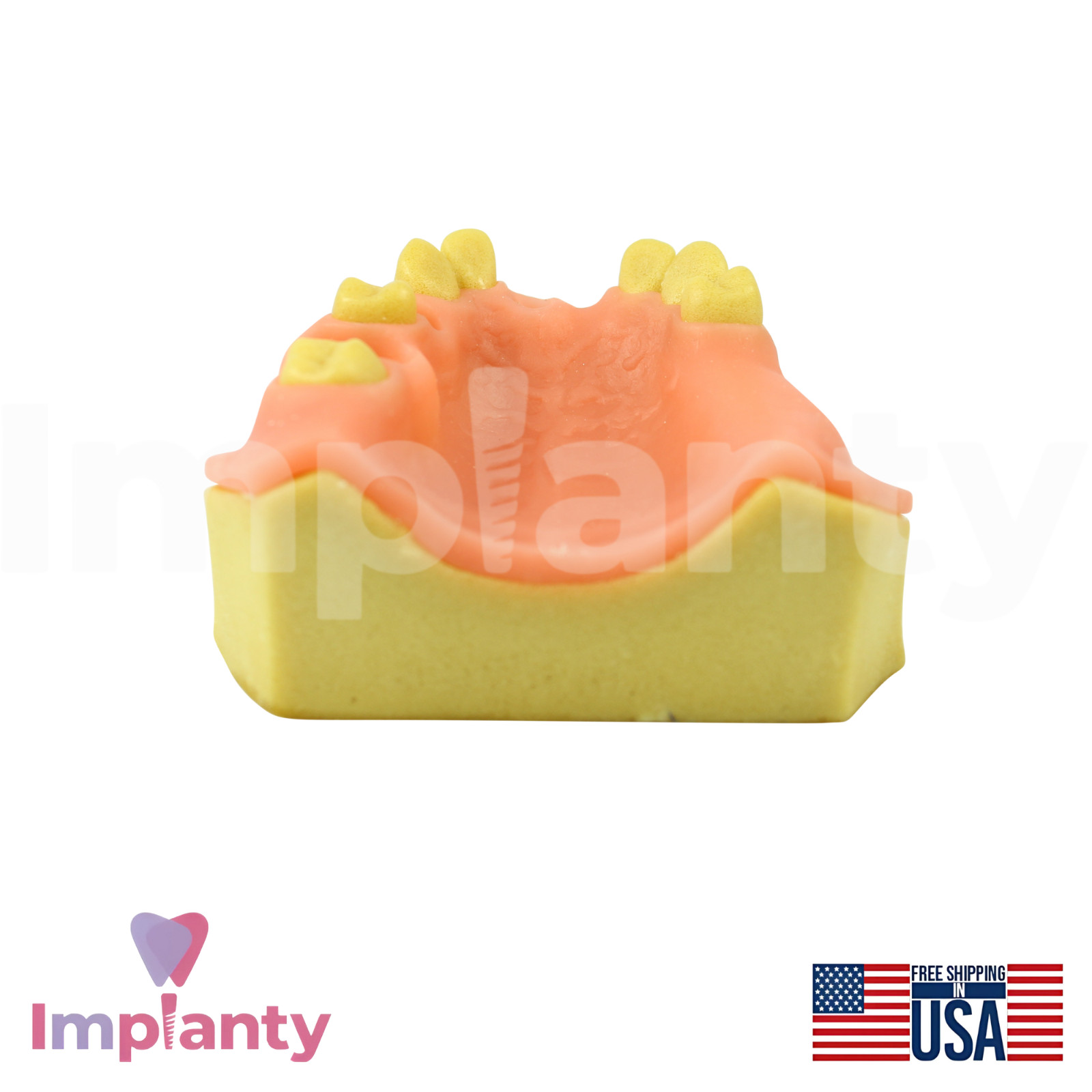 Upper Jaw Model With Missing Teeth Dental Teaching and Dentistry Practice Aid