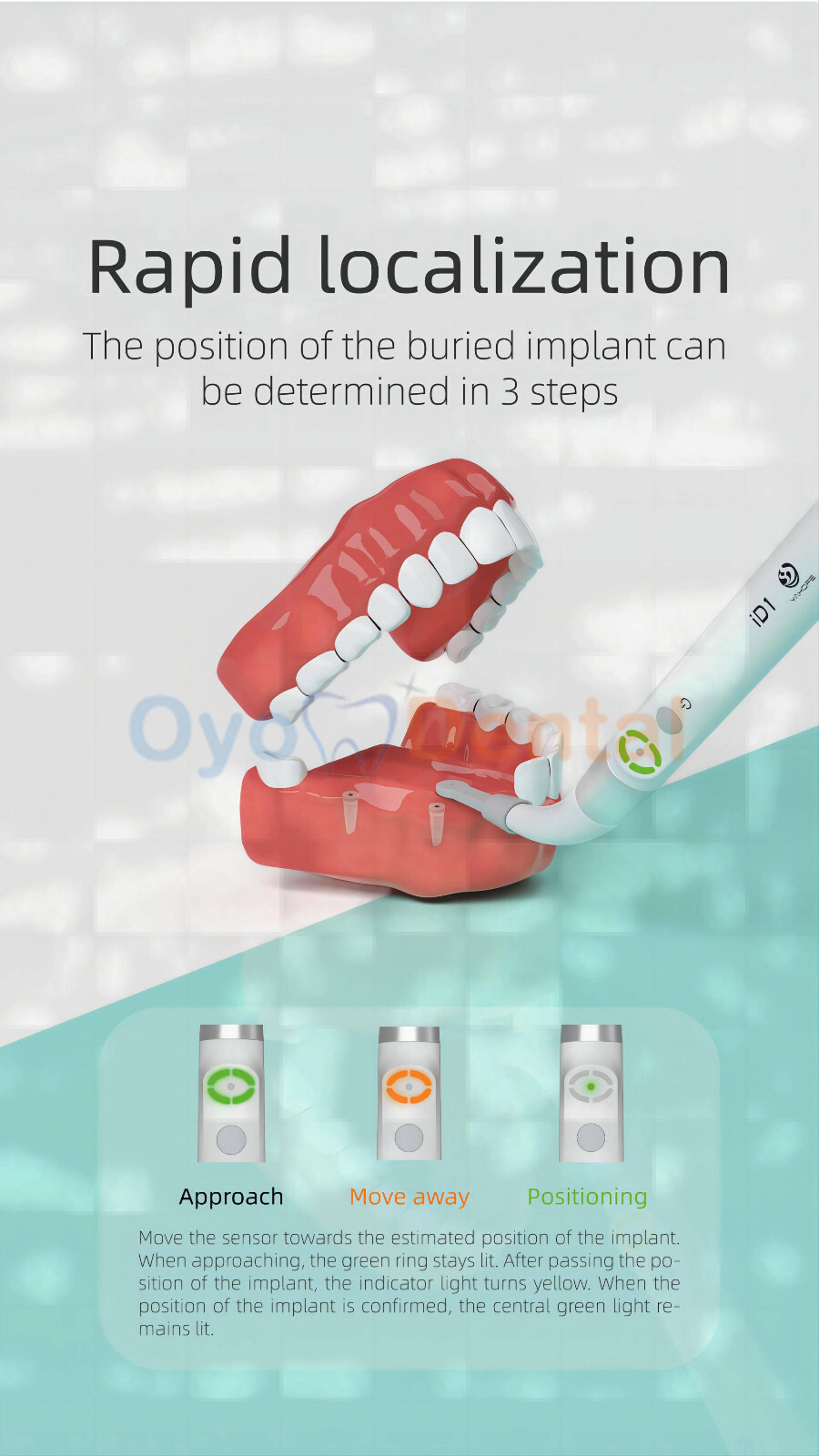 Dental Implant Detector Implant Abutment Locator Tool Smart 360° Rotating Sensor