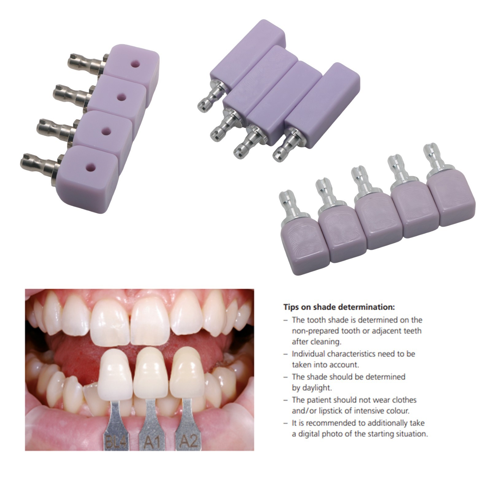 5PCS C14 Dental Emax Glass Ceramic Blocks Lithium Disilicate CAD/CAM CEREC Block