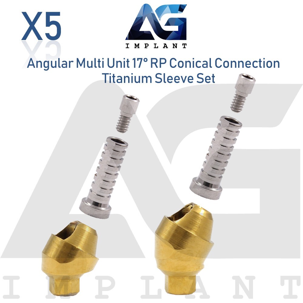 5 Angular Multi Unit Prosthetic System 17° Conical Connection RP Titanium Set