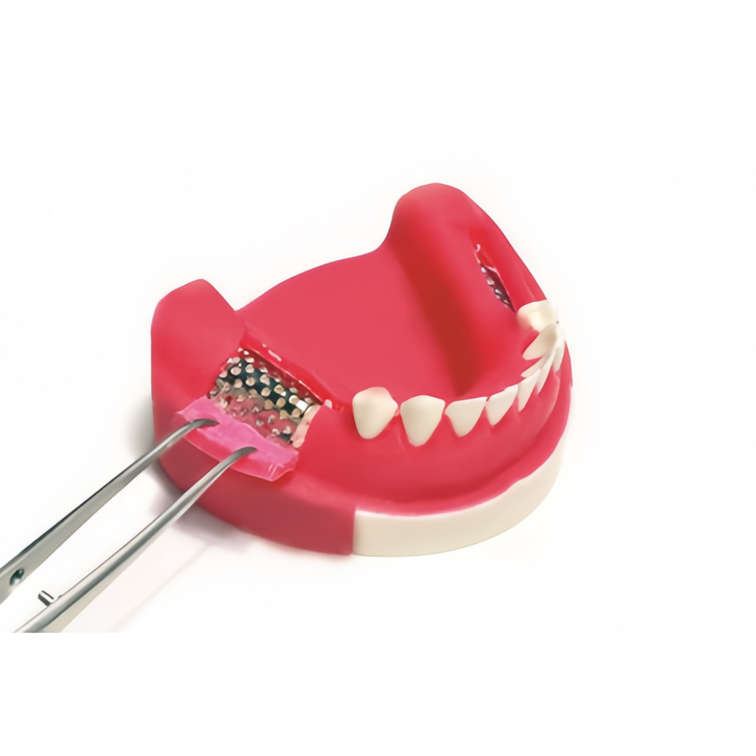 Dental GBR Titanium Mesh Membrane Guided Regeneration Plate Barrier USA