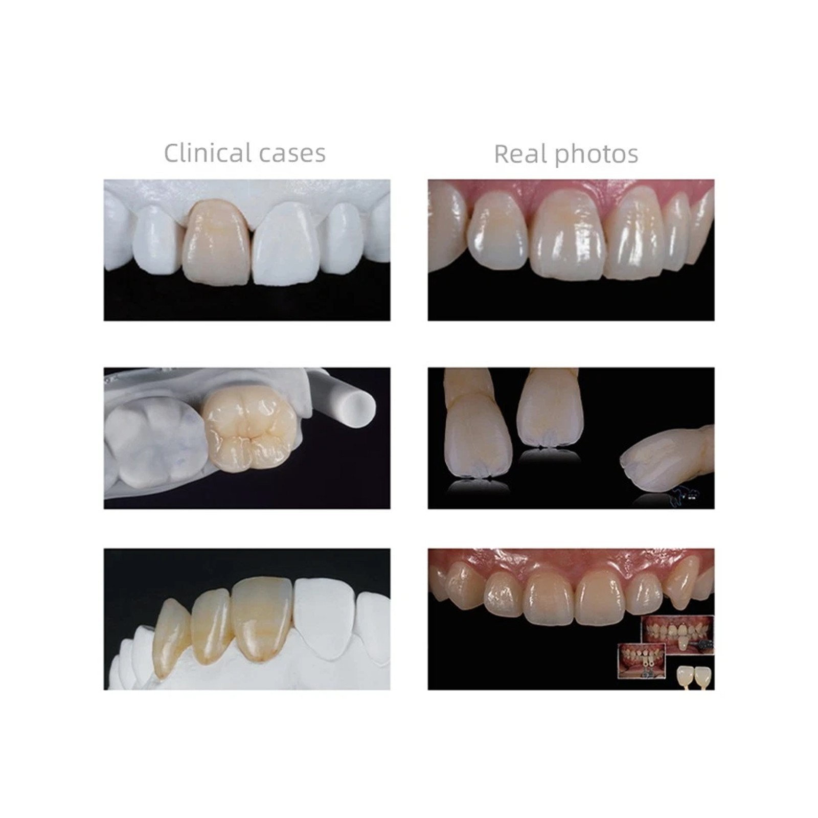 US Dental Emax Ceramic Blocks C14 HT Lithium Disilicate CAD/CAM CEREC Block