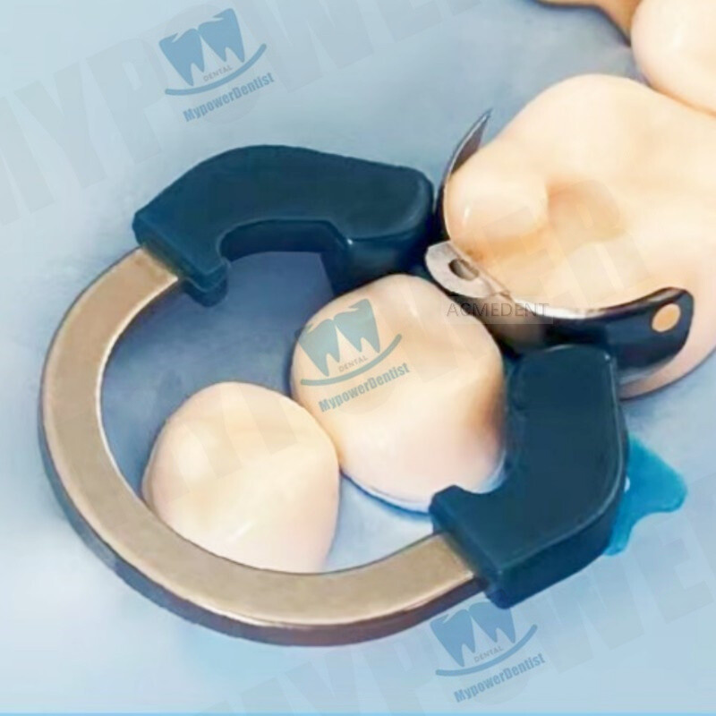 Dental Matrix Bands Ring Sectional Matrice Clamp Fit Palodent V3 System