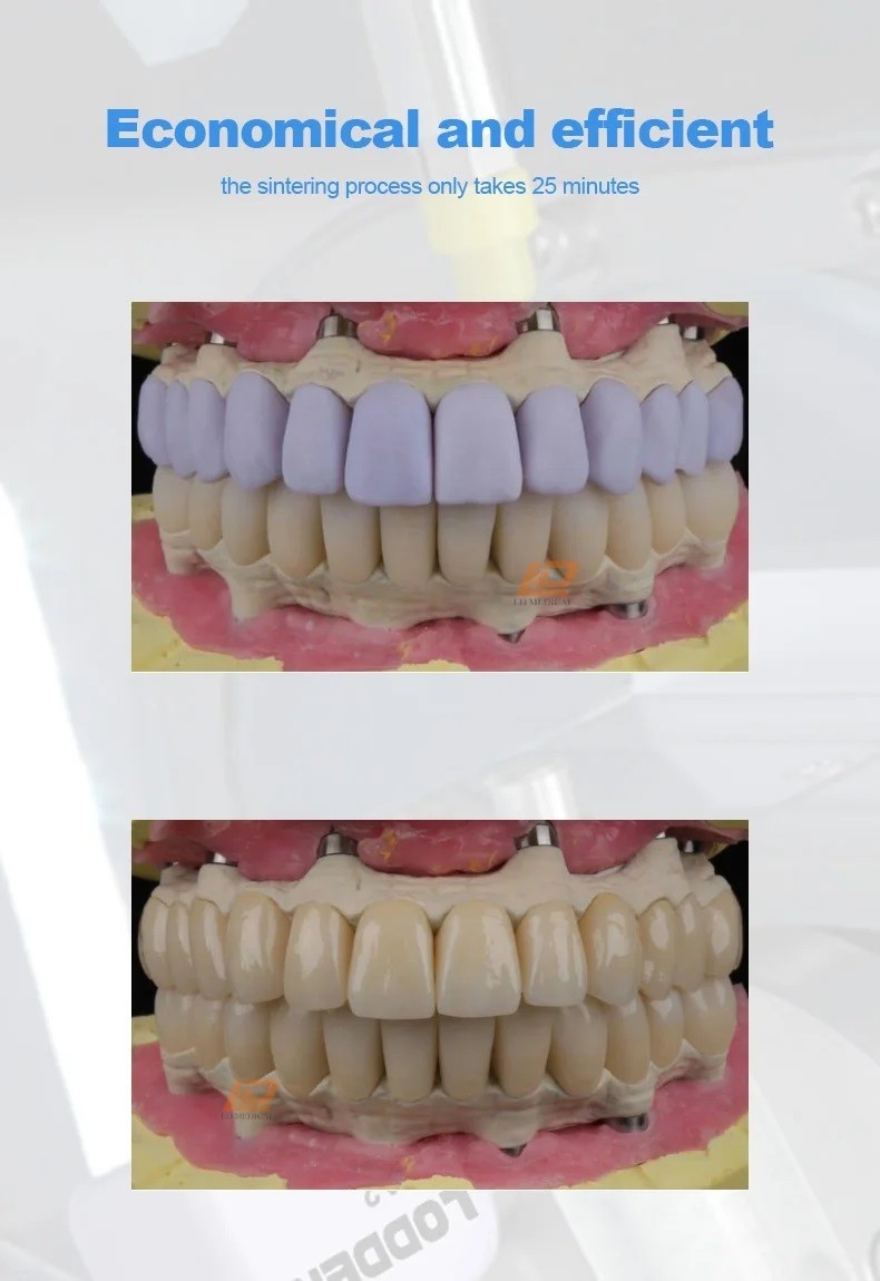 IPS e.max CAD A16 Dental Lithium Disilicate Block CEREC CAD CAM Glass-ceramics