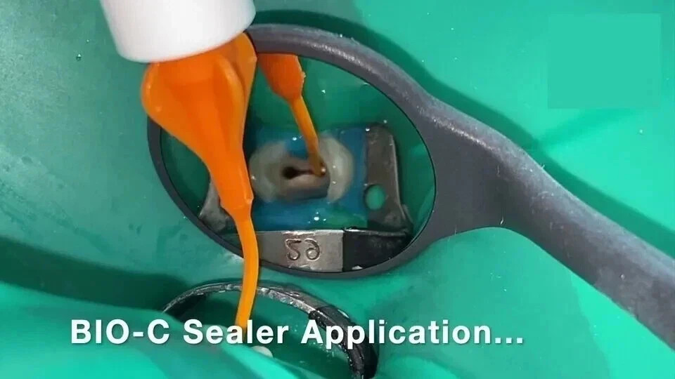 Angelus Dental BIO C SEALER 0.5g Syringe Bioceramic RCT Selaer