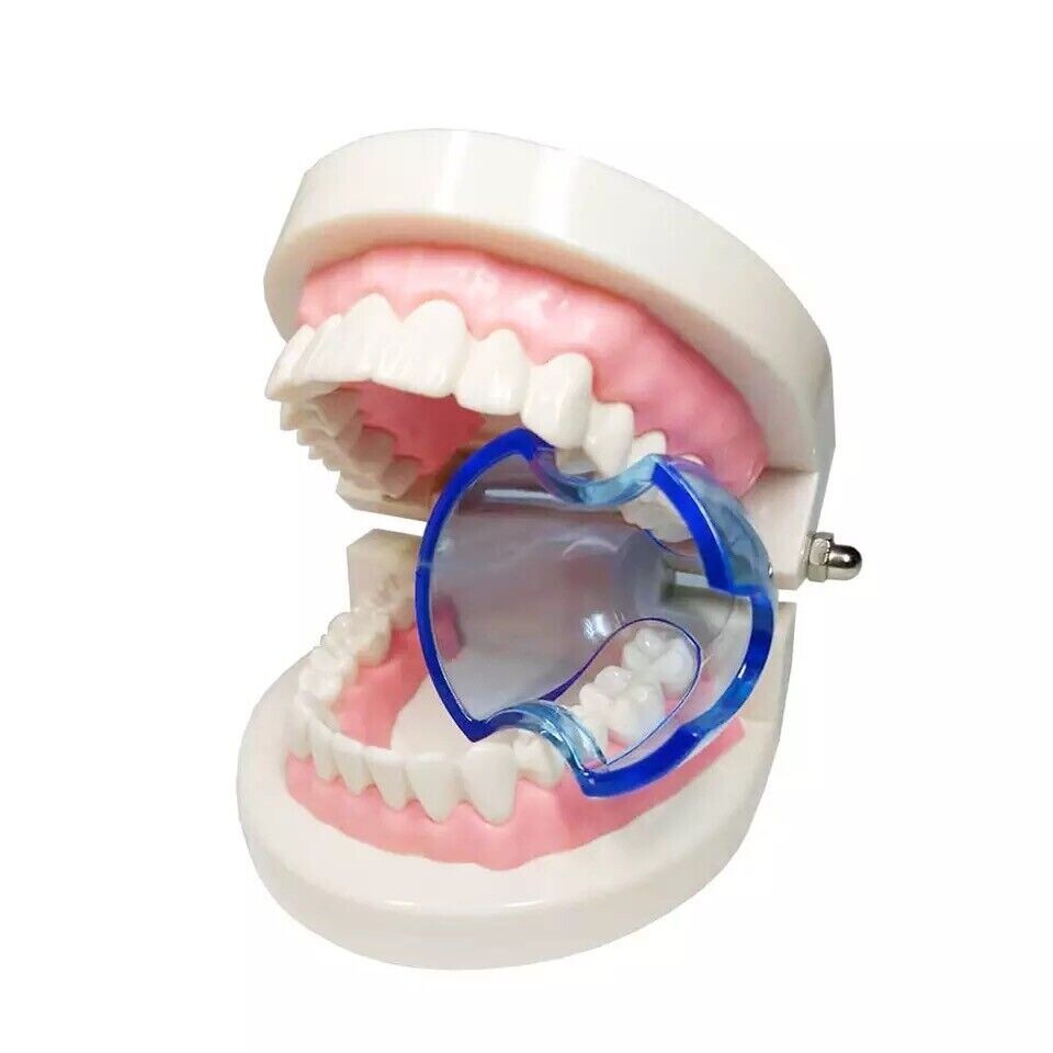 5 PCS Dental Mouth Gag Opener Posterior Teeth Props Retractor Cheek Expander