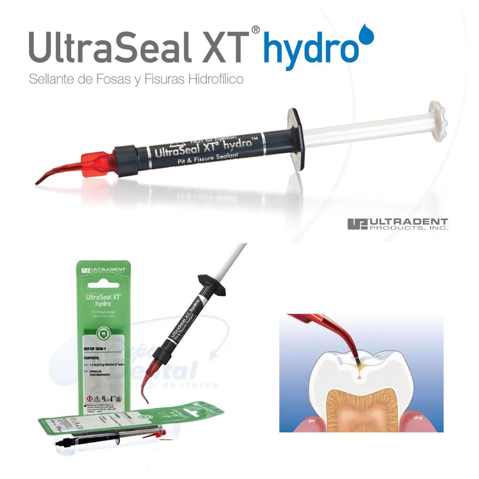 4Pcs Ultradent UltraSeal XT Hydro Flowable Dental Sealant 1.2ml