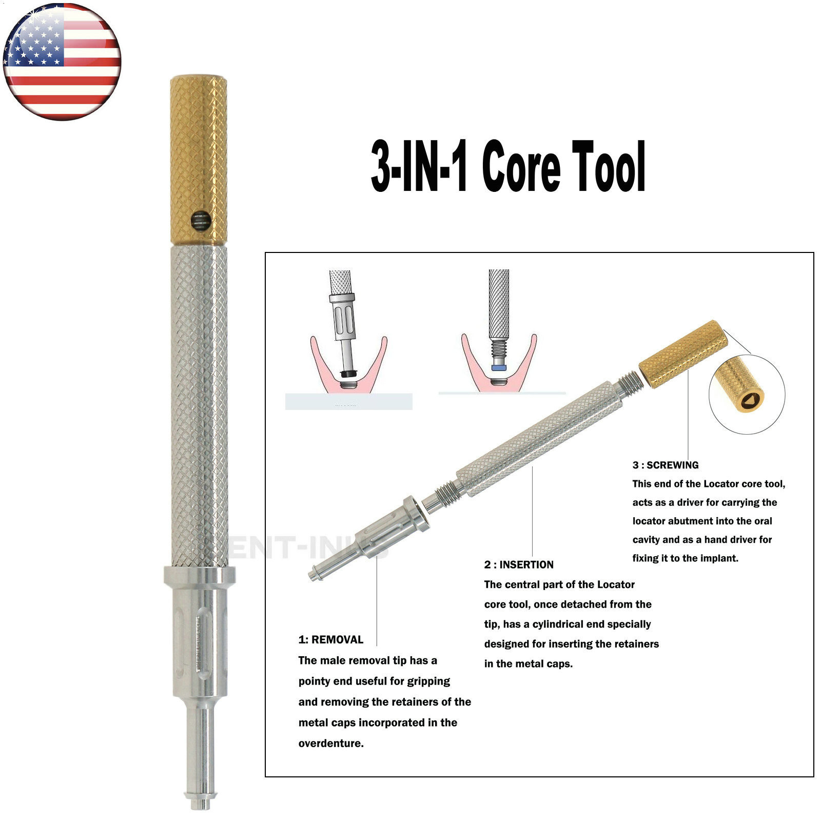US Dental Regular 3mm Locator Abutment & Overdenture Male Caps Kits for Hiossen