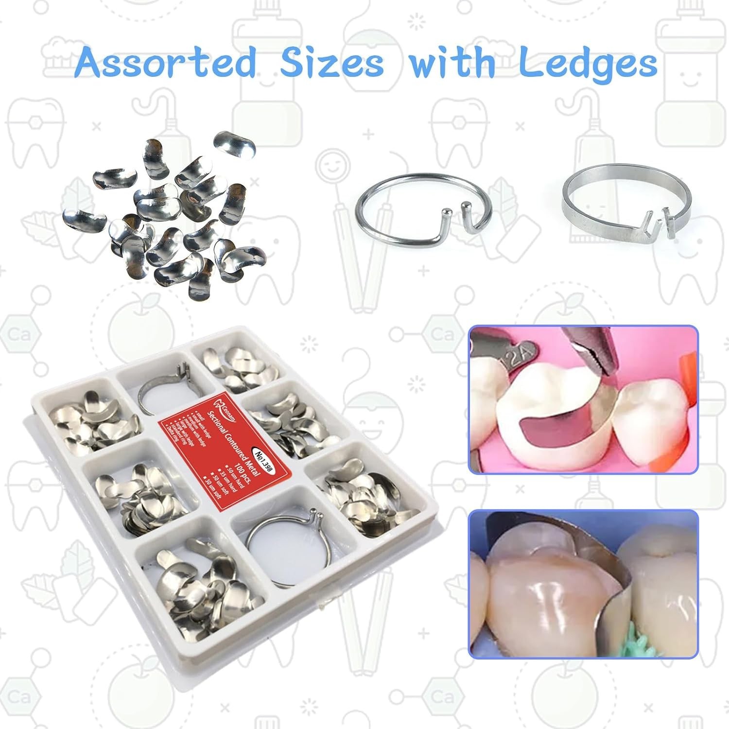 100-Piece Stainless Steel Dental Matrices Kit – Precision for Molar & Premola…
