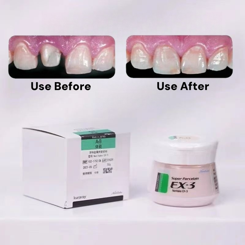 Super Porcelain Powder Body Noritake EX-3 For Metal Ceramic Dental Restorations