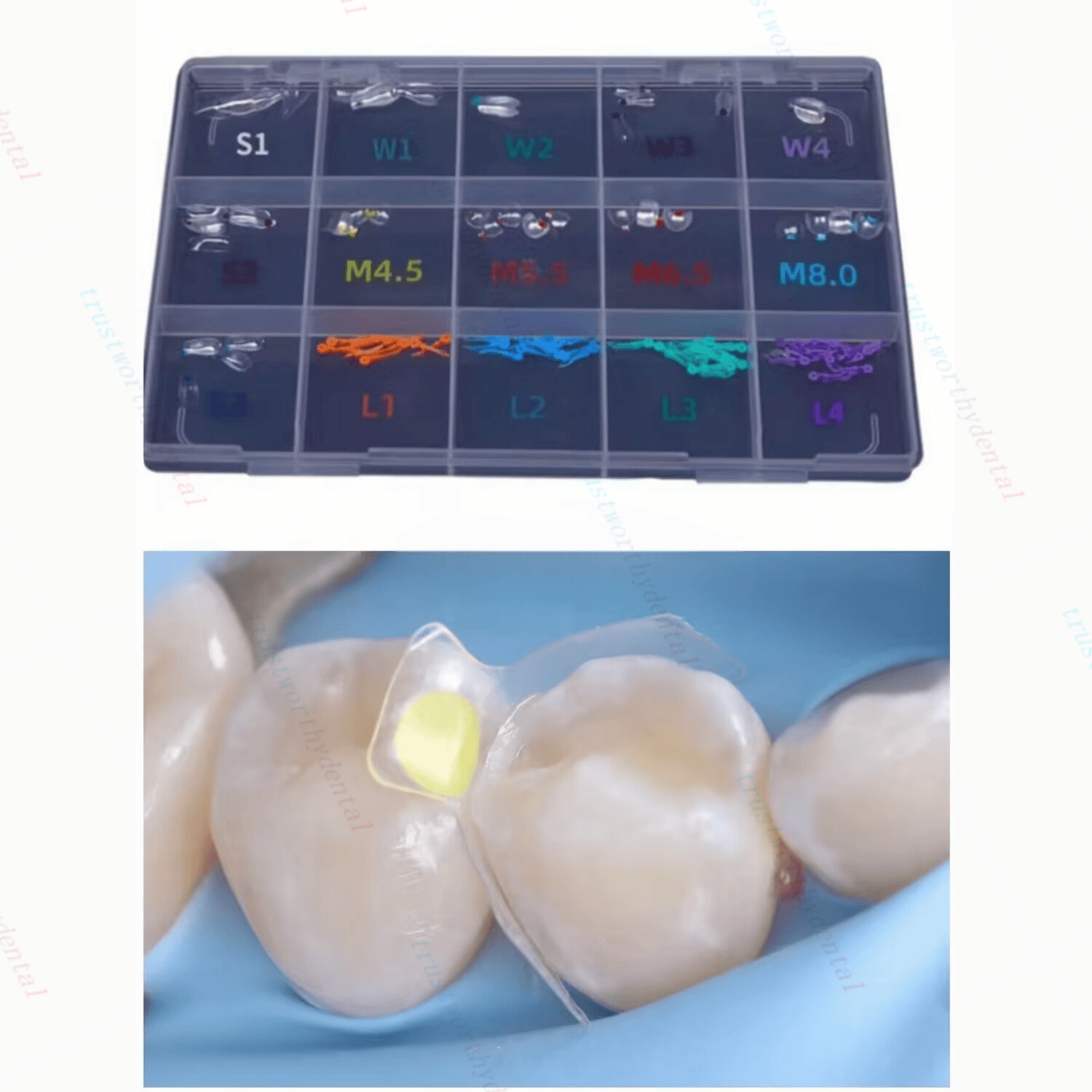 Clear Matrix Dental Anterior Matrices Posterior Class II Fit BioClear Fit Biofit