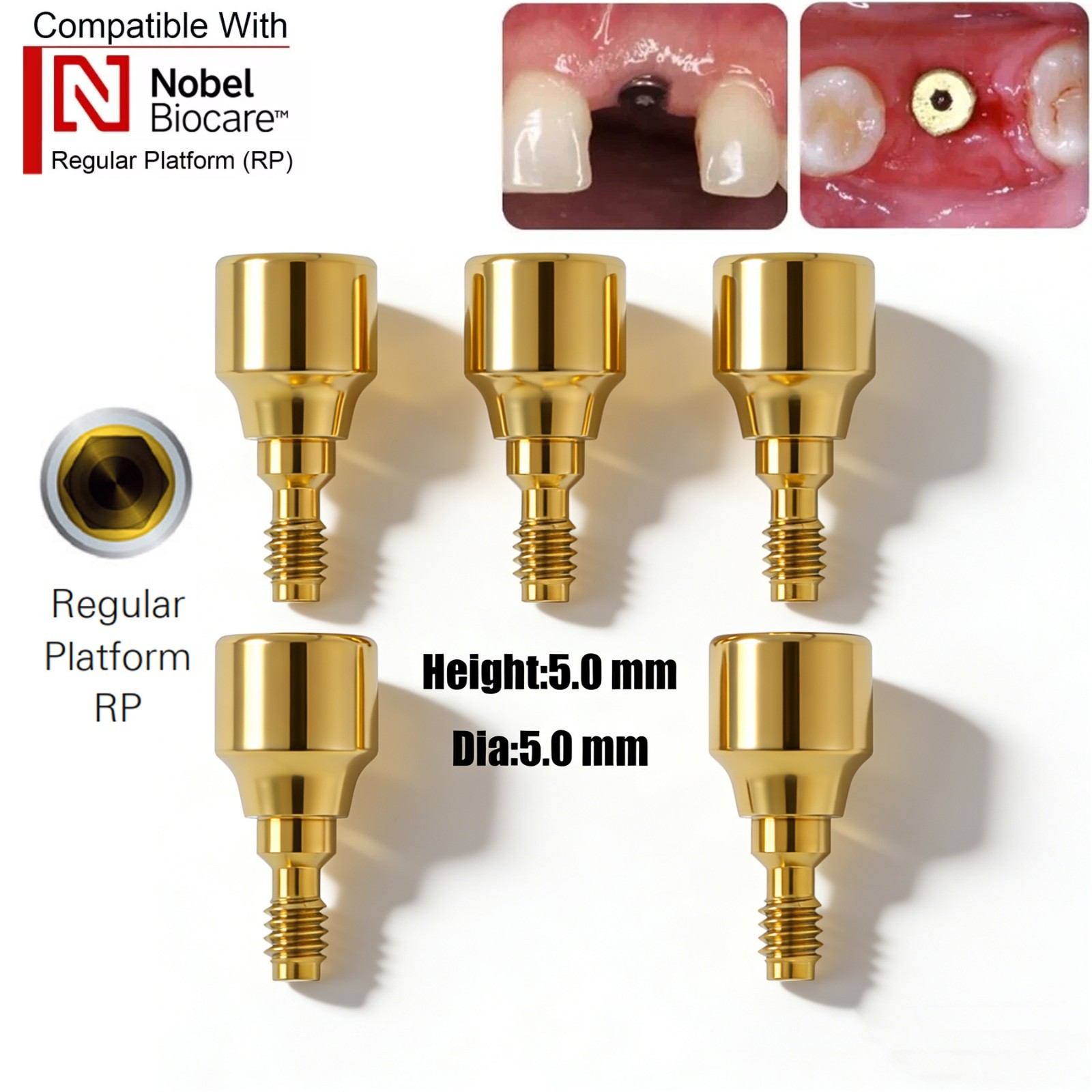 US Nobel Biocare Titanium Healing Abutment NP RP Internal Conical ∅3.6/5.0/6.0mm
