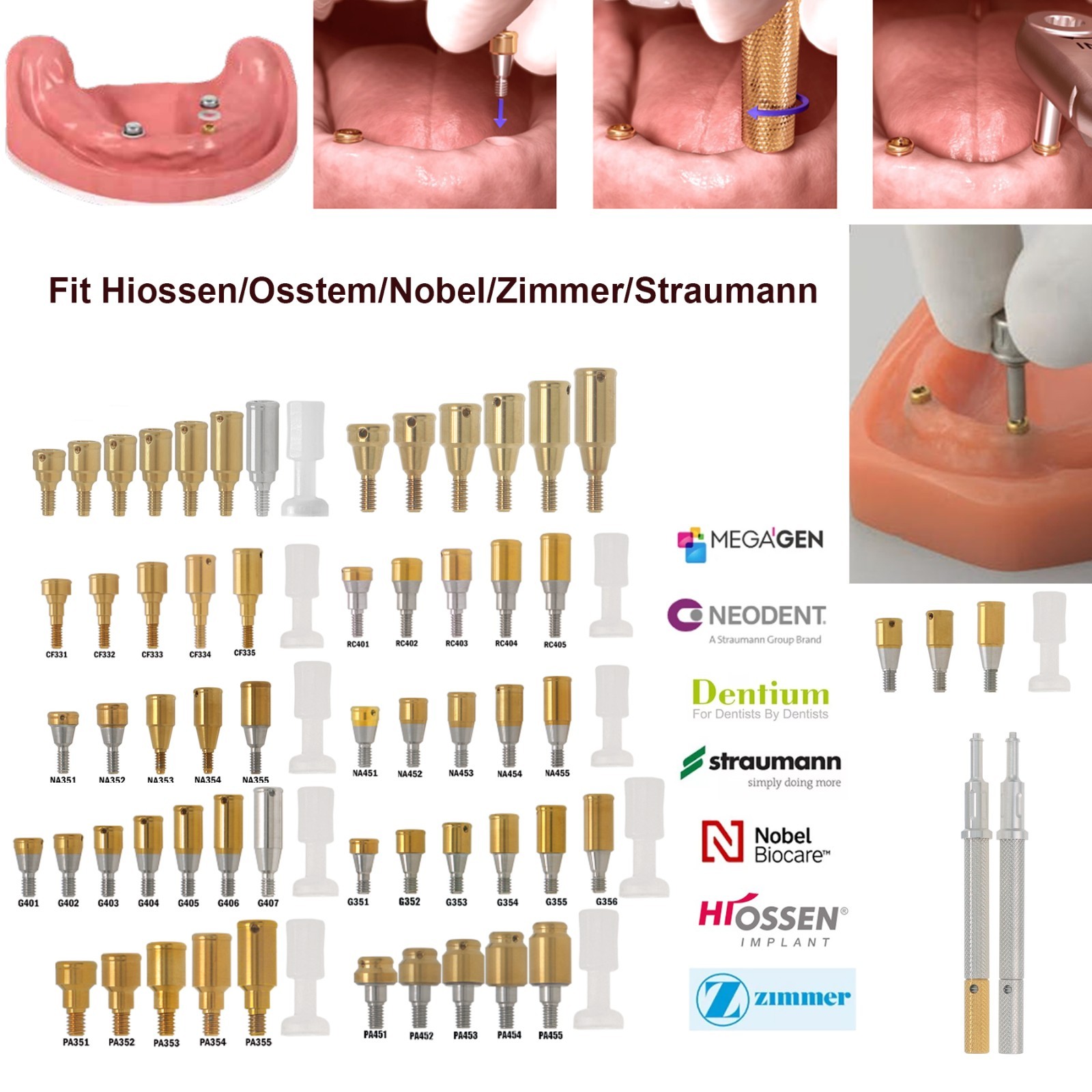 Dental Zest Locator Overdenture Attachment System Compatible Multiple Implant