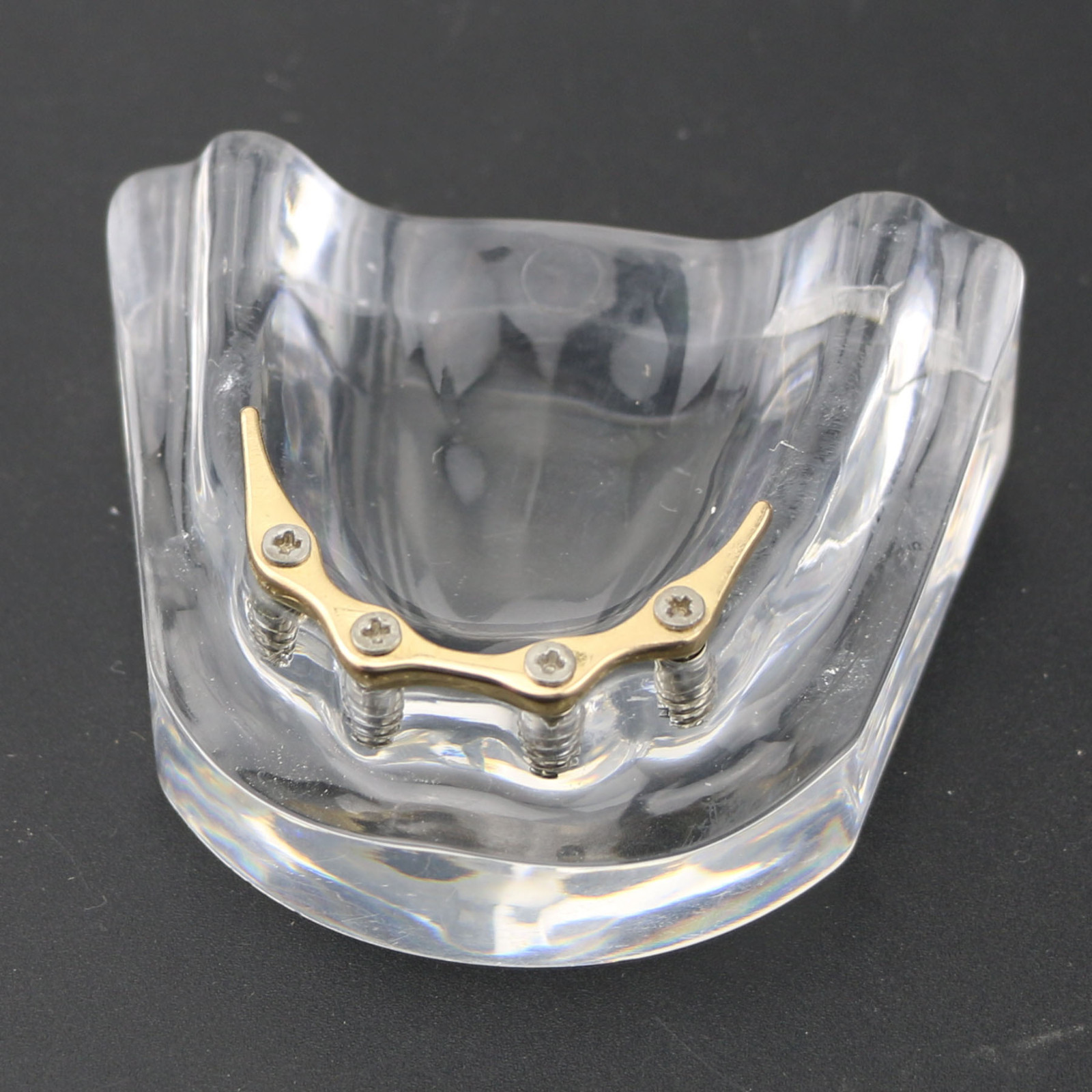 Dental Teeth Implant Model Inferior Overdenture 4 Implants Denture Demo Training