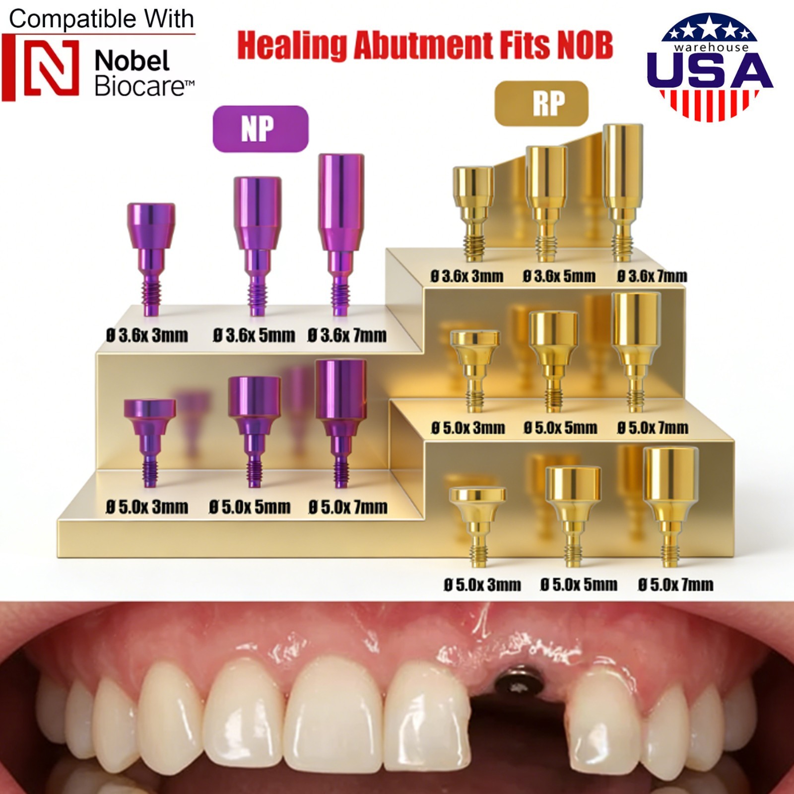 US 5Pc Dental Healing Abutment NP/RP Fit Nobel Biocare Internal Conical Titanium