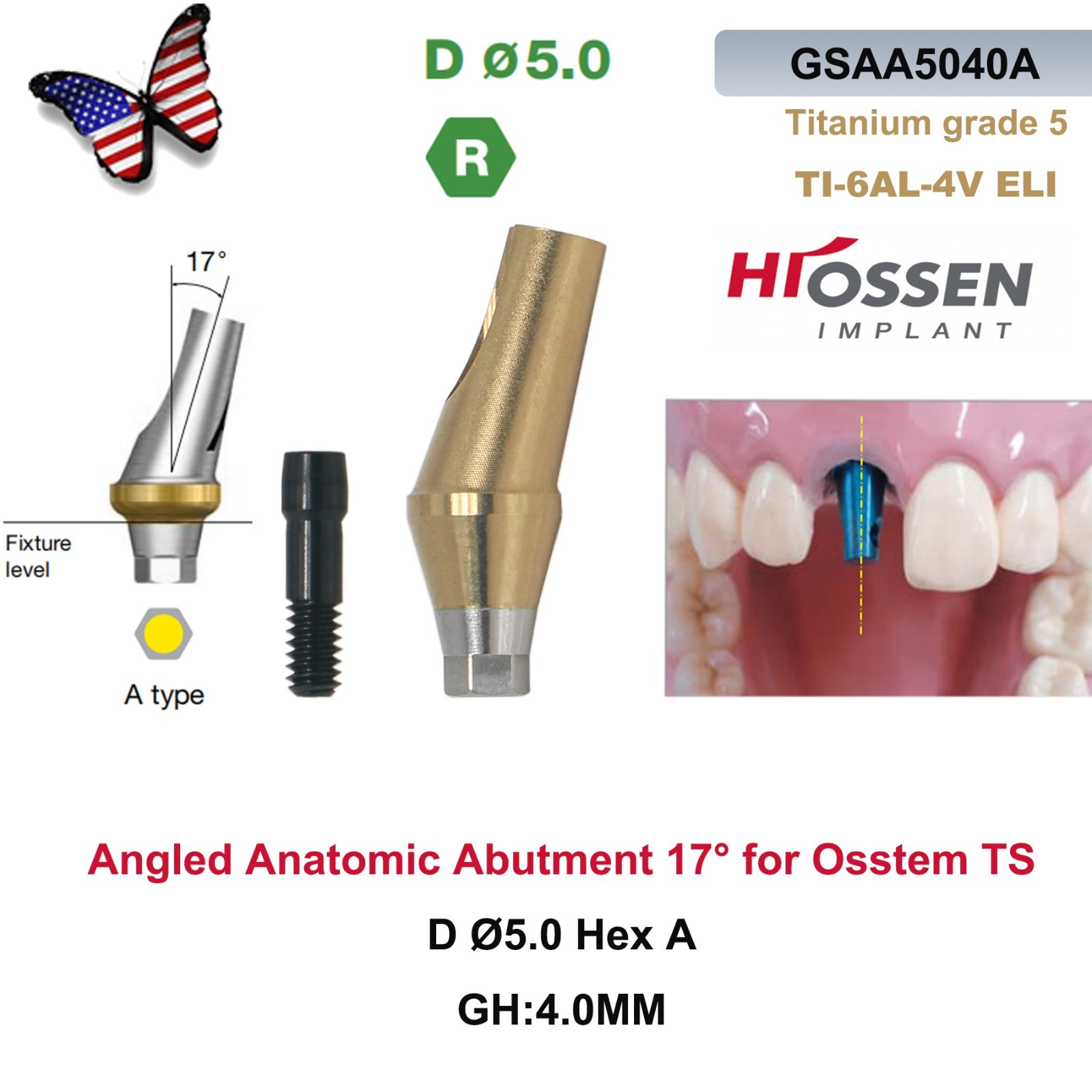 US Dental 17° Angled Abutment For Hiossen ET III Osstem TS Mini Regular Platform
