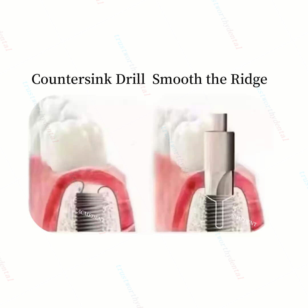 Dental Level Bone Profiler Remover Implant Shoulder Interfere Trimmer Drill