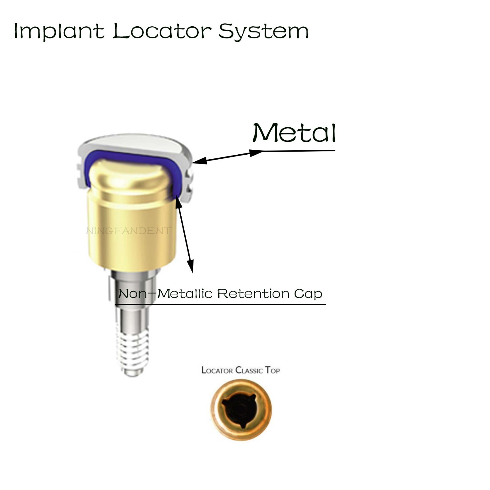 20Pcs Dental Locater Replacement Metal Housing & Lab Cap Assembly