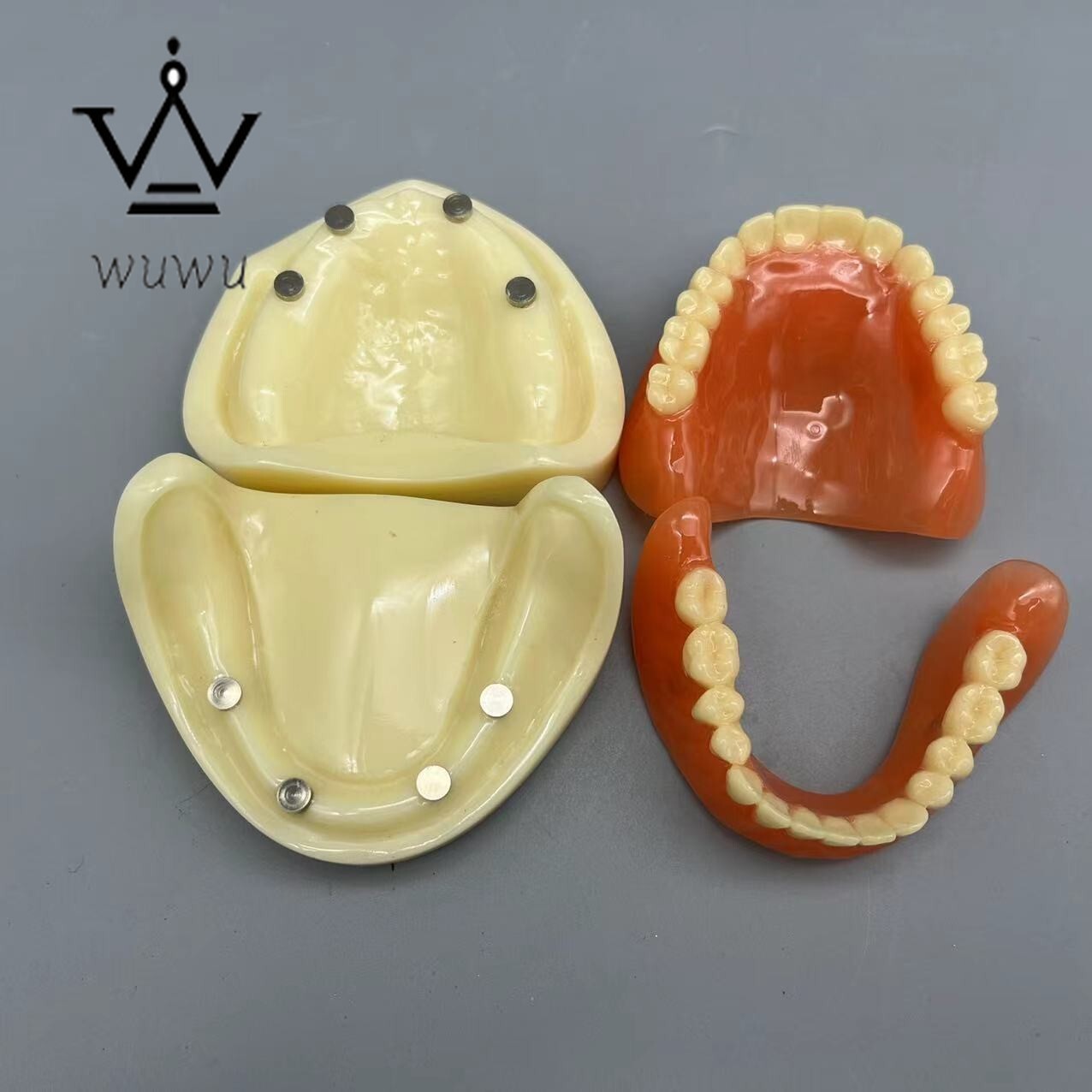 Dental 4 Implants Overdenture Typodont Restoration Upper Lower Lower Teeth Model