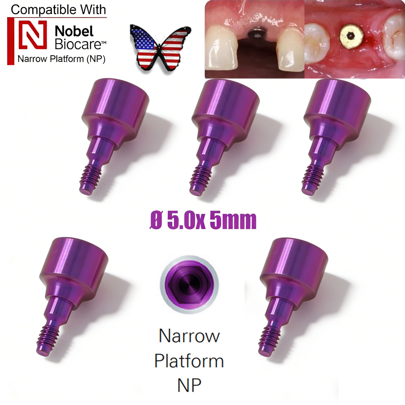 Dental RP NP Healing Abutment Compatible NobelActive Internal Conical Connection