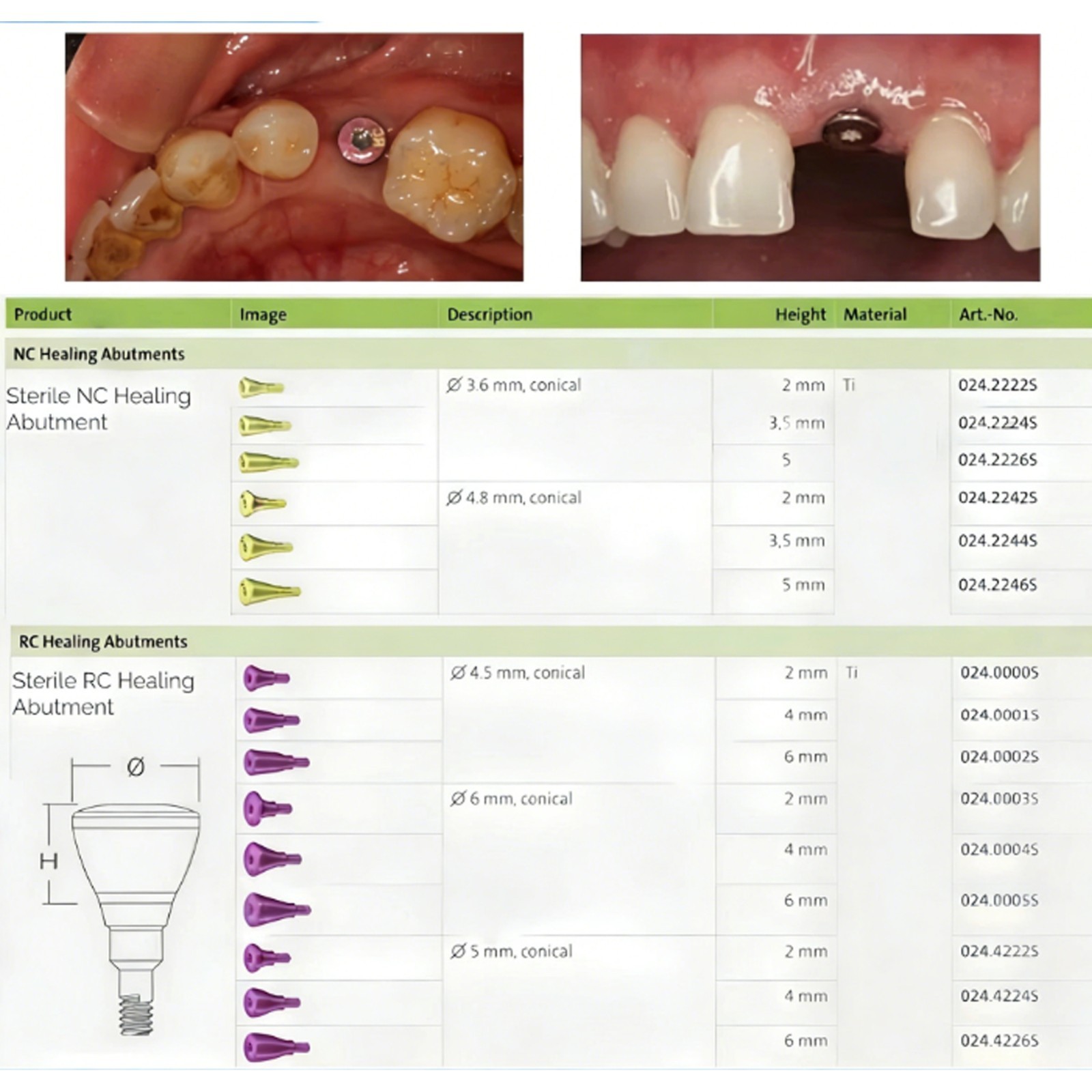 Multiple Implant Healing Abutment & Closure Cover Screw Hiossen Nobel Straumann