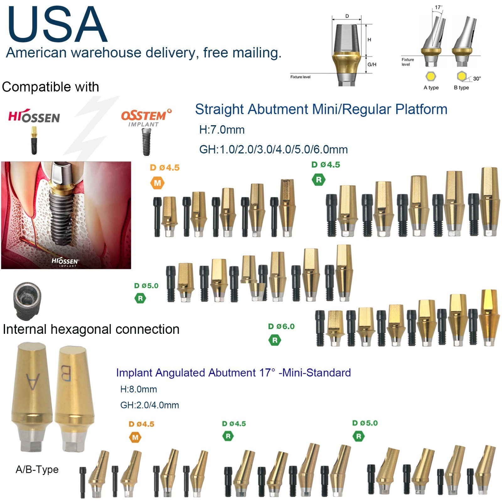 US Dental Prosthetics Angled 17°/Straight Titanium Abutment fit Hiossen ET OSS