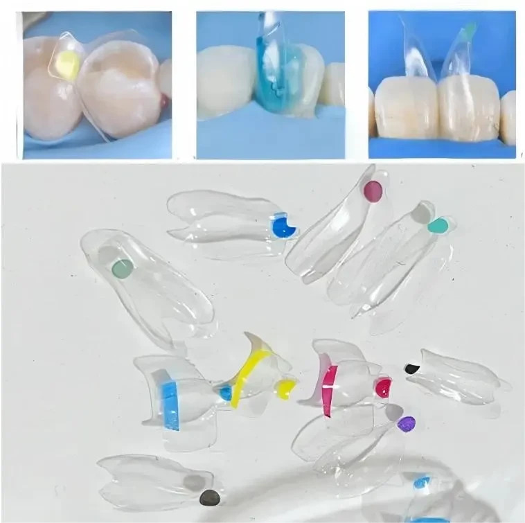 Dental Transparent BT Matrices Clear Matrix Anterior Posterior Fit BioClear