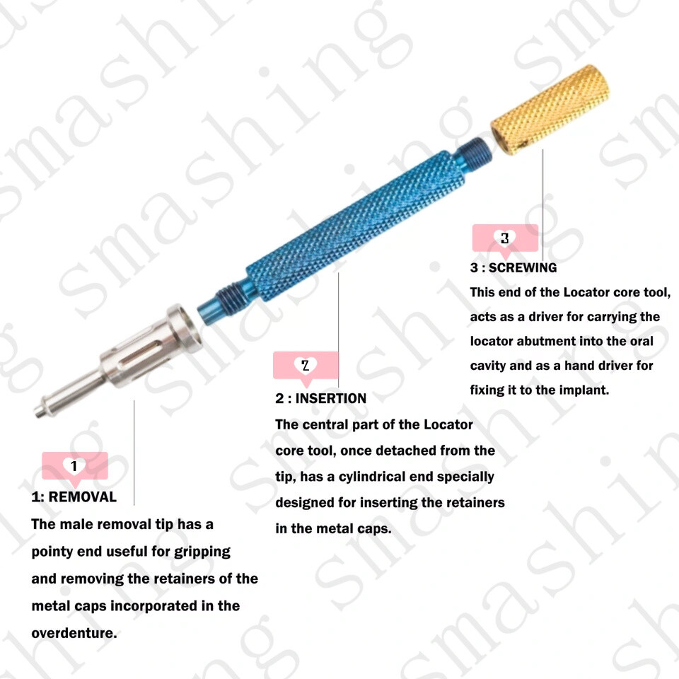 Dental Extraction Locator Core Universal Implant Retention Caps Insertion 3-in-1