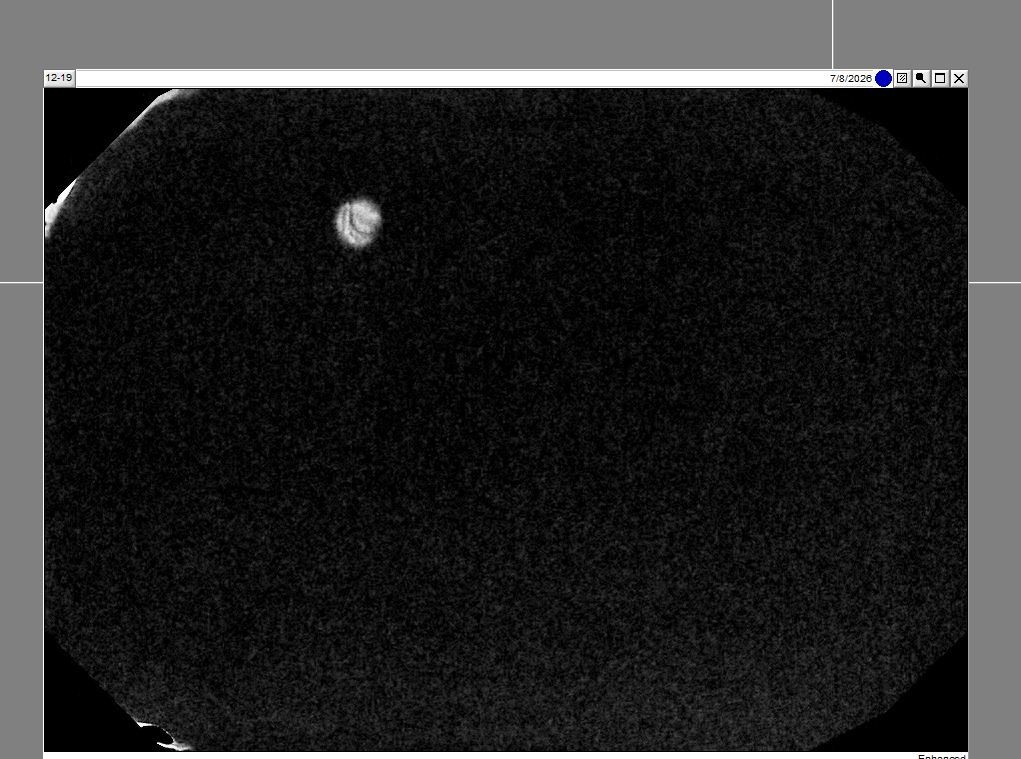 Dexis/Kavo IXS Size 2 Sensor _SEE PICTURES AND IMAGES_