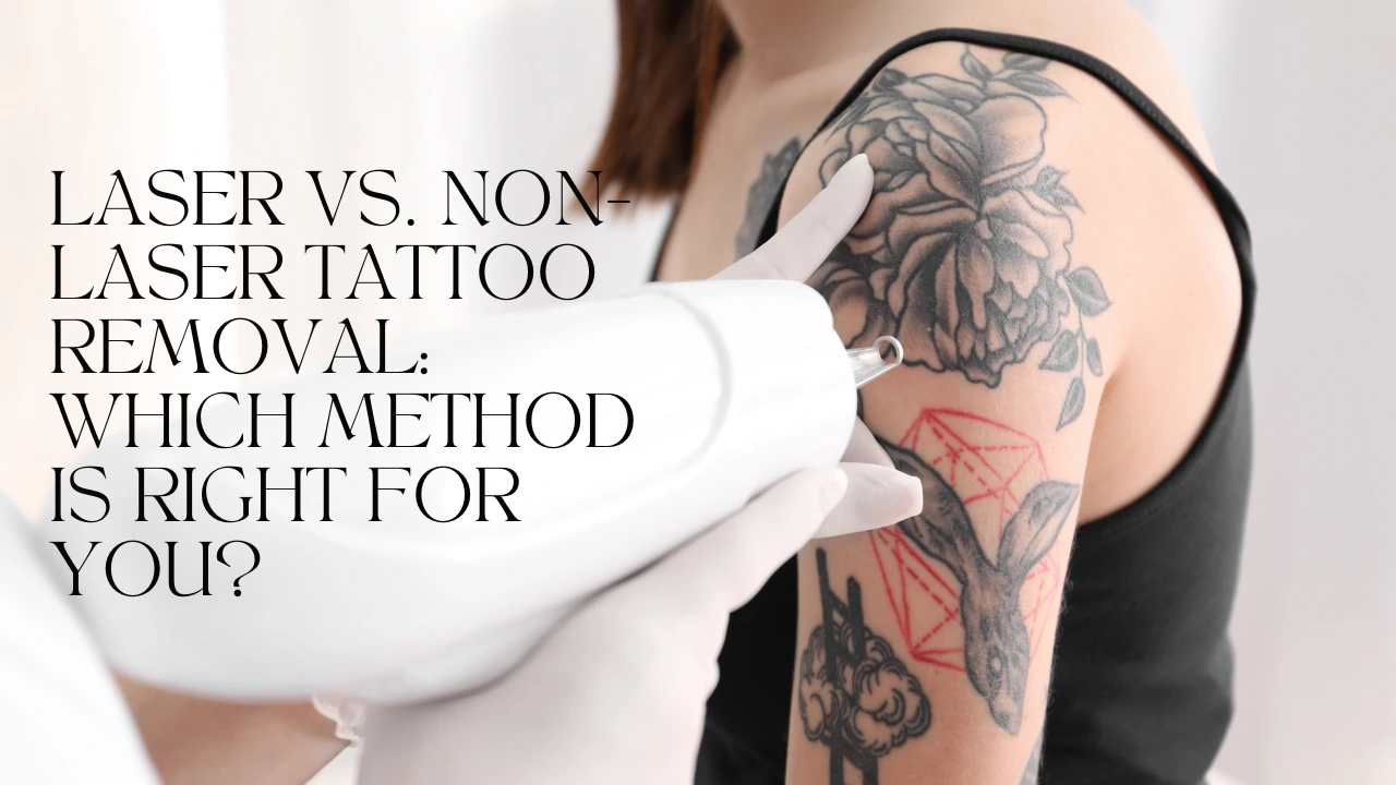 A close-up image of a professional tattoo removal procedure being performed. A handheld laser device is directed at a tattoo on a person's upper arm, featuring intricate designs. The text overlay compares laser tattoo removal with non-laser alternatives