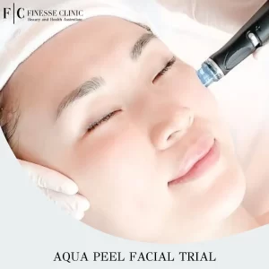 Aqua Peel Facial Trial