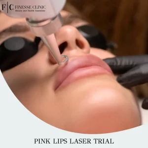 Pink lips laser trial