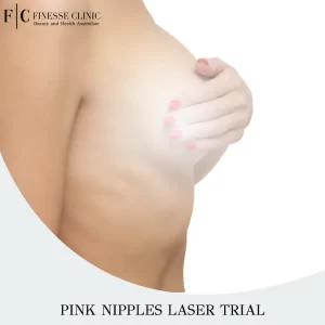 Pink nipples laser trial