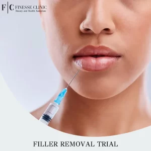 Filler Removal Trial