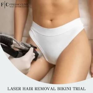 Laser Hair Removal Bikini Line Trial