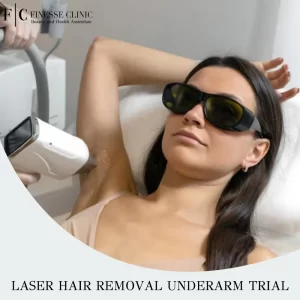 Laser Hair Removal Underarm Trial
