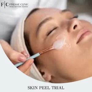 Skin Peel Trial