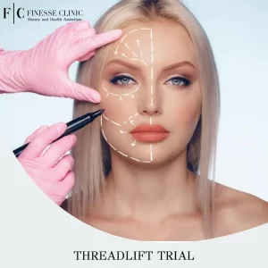 Threadlift Trial